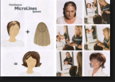 Microlines